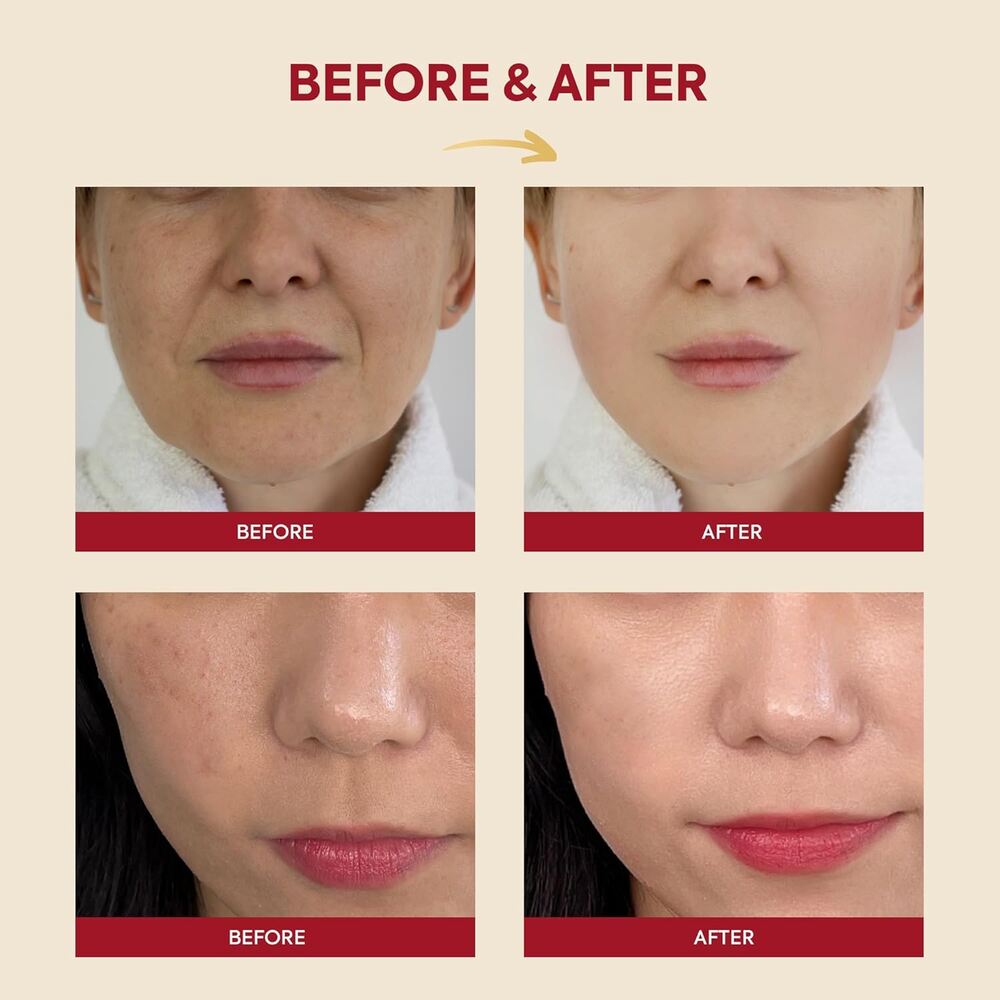 K-SECRET Essence Snail Mucin 97% + Rice