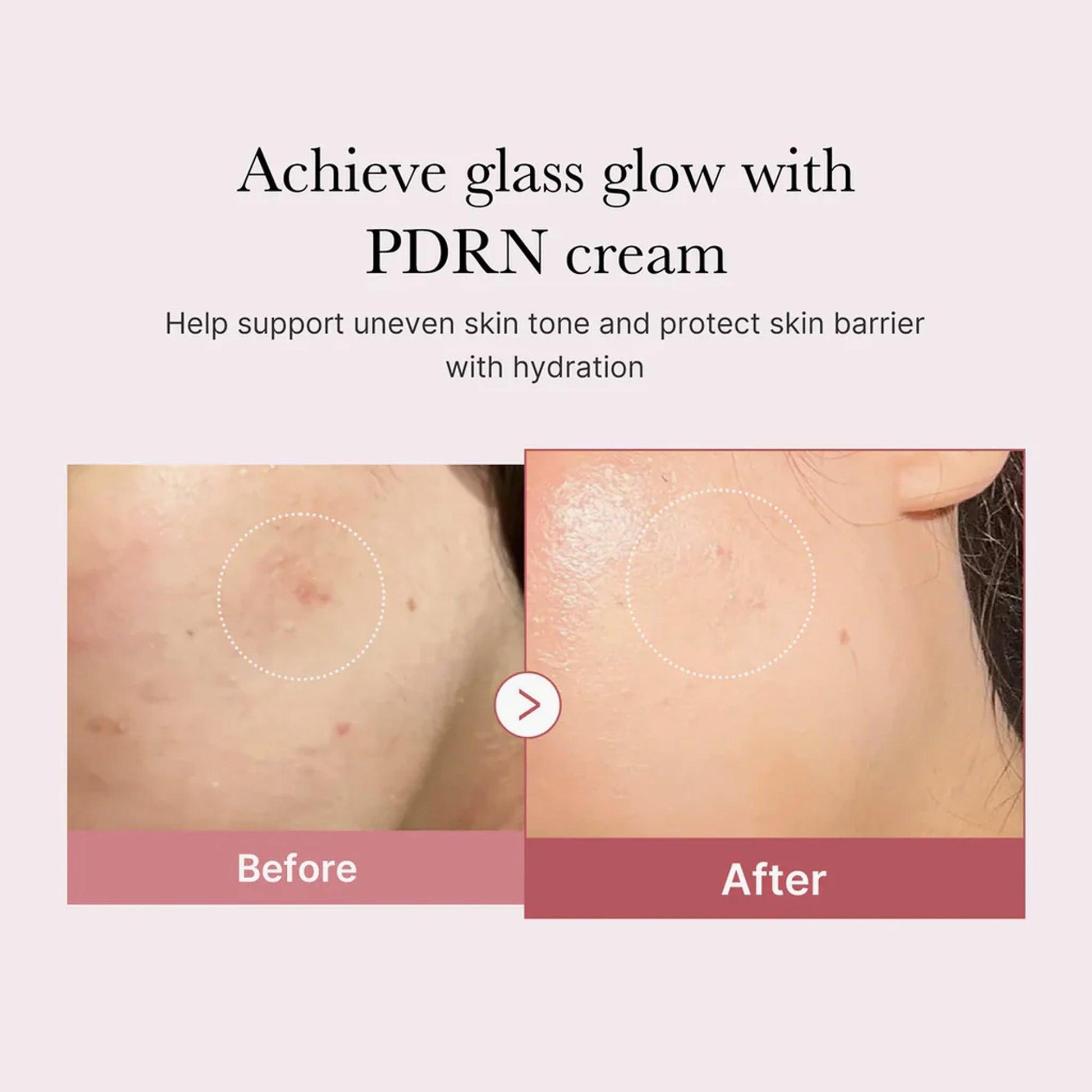 medicube pdrn pink hyaluronic moisturizing cream 50ml reviews